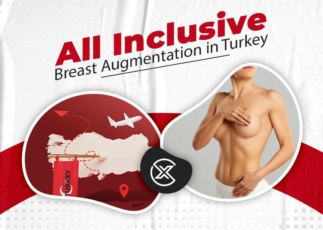 all inclusive breast augmentation in turkey, breast augmentation in turkey, breast augmentation turkey, breast augmentation turkey cost, turkey breast augmentation package, breast augmentation in turkey cost