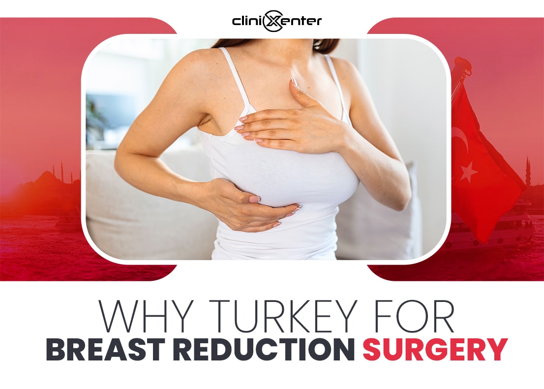breast reduction surgery in turkey, breast reduction turkey, breast reduction in turkey